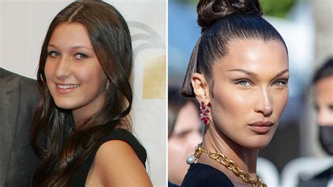 bella hadid fans question why she was allowed surgery at 14 capital