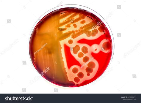 Closeup Hemolysis Zone Bacterial Colonies Growth Stock Photo 1857729799