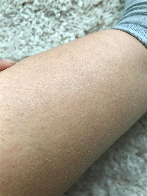 Why is the skin on my legs always scaly and dry? [Skin Concern ...