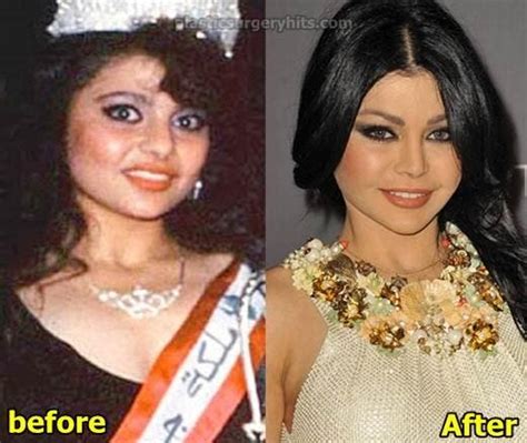 Haifa Wehbe Aint No Natural Beauty According To Her Plastic Surgeon