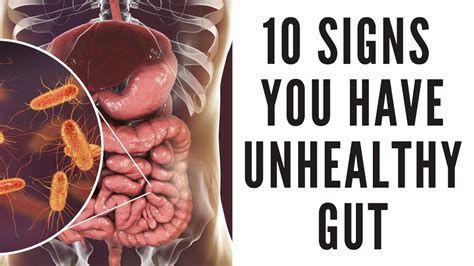10 signs you have unhealthy gut common gut problems that may affect your overall health youtube
