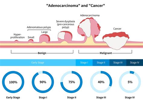 As Colorectal Cancer For The Under 50s Rises Regular Screening Is Vital To Facilitate Earlier