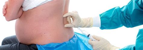 Pda) wird auch epiduralanästhesie genannt und betäubt den unteren bereich deines körpers. The Facts Behind An Epidural - HealthyPregnancy.com