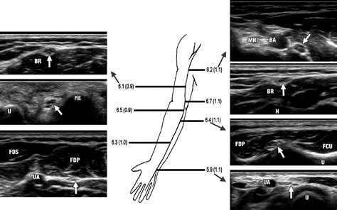 Ultrasonographic Findings Of The Normal Ulnar Nerve In Adults