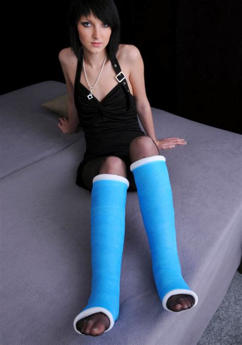 Thumbs Pro Double Short Leg Casts And Pantyhose Medical Fetish Feet Cast Fetish Plaster