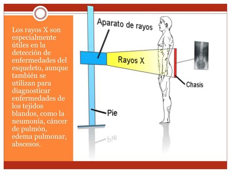 Ppt Implicaciones Principales De Los Rayos X Powerpoint Presentation