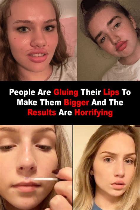 People Are Gluing Their Lips To Make Them Bigger And The Results Are