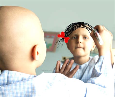 Cura Do Câncer Infantil Chega A 70 Dos Casos Com Diagnóstico Jne