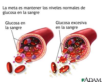 MedlinePlus Enciclopedia Médica Glucosa en la sangre
