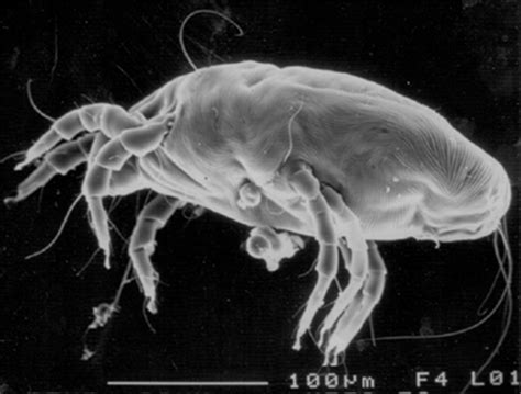 Home Environmental Interventions For House Dust Mite The Journal Of