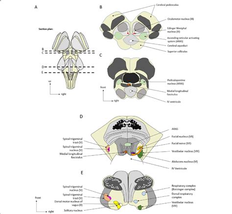 Anatomical Axial Sections Of The Brainstem A Representation Of The