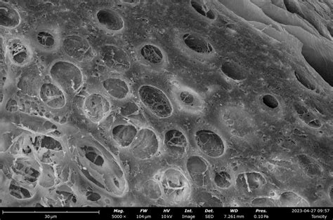Visualizing Skin Tissue Morphology With Scanning Electron Microscopy