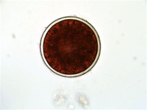 Haematococcus Pluvialis BGprojectz