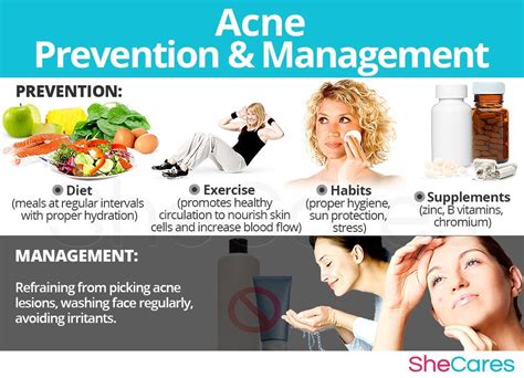 Acne Prevention And Management Prevent Acne Acne Nourishing Skin