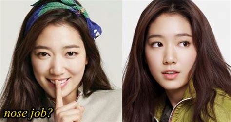 Park Shin Hye Before And After Plastic Surgery Celebrity Plastic