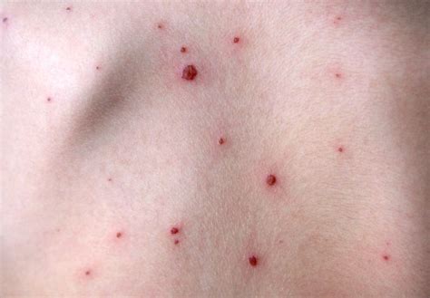 Common Skin Diseases And Conditions Explained