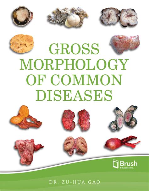 Gross Morphology Of Common Diseases Livres Canada Books
