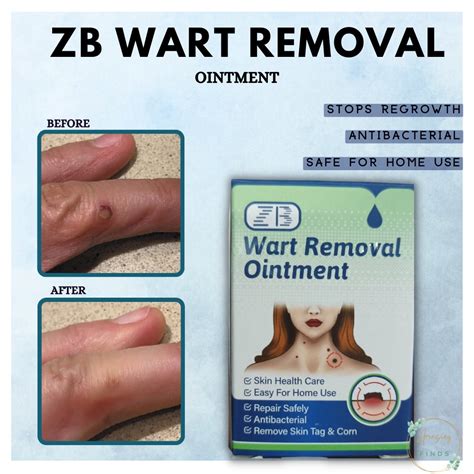 Body Warts Remover Cream Skin Tag Remover Corn Plaster Antibacterial