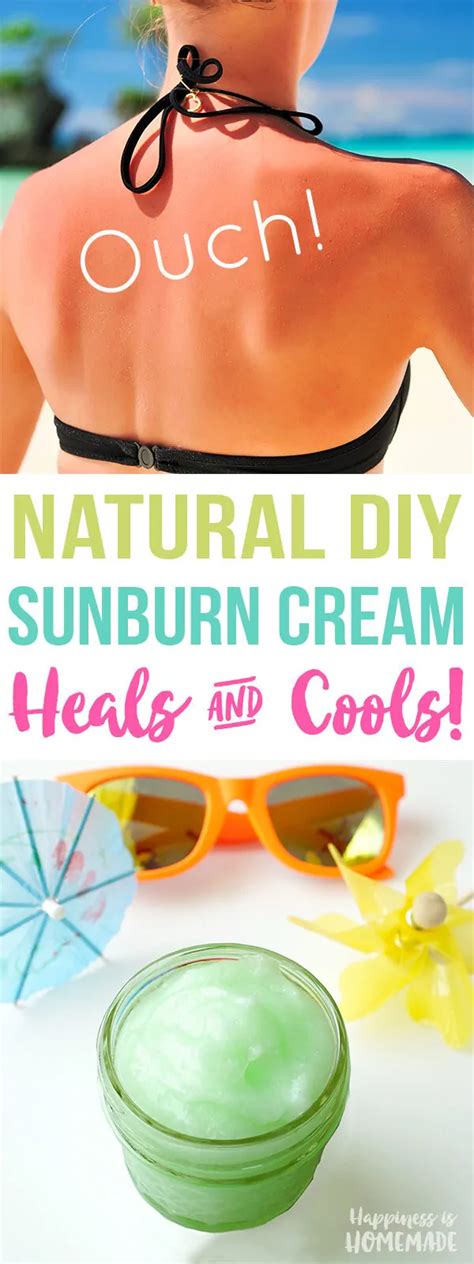 Excellent Homemade Sunburn Relief Remedies All For Fashion Design
