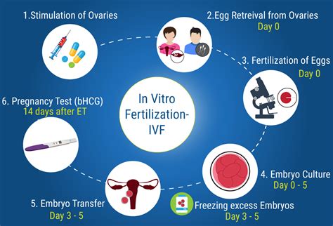 in vitro fertilization ivf mediologiest