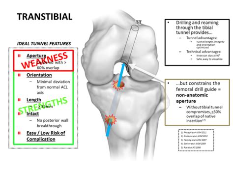 Comparison Transtibial Vs Am Portal Vs Hybrid Technique Danamed