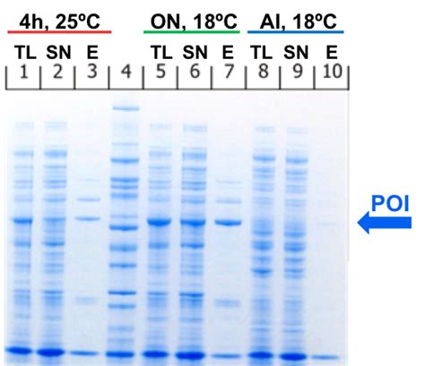 Small Scale Expression And Purification Tests Protein Expression And