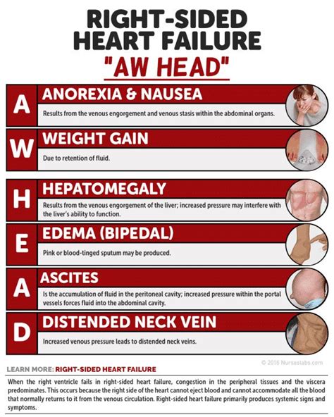 Right Sided Heart Failure Mnemonic Aw Head Anorexia Grepmed
