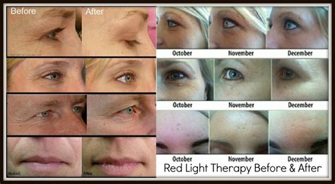 Light Therapy, Where Science Meets Magic! | Red Light Therapy