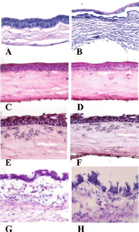 Hematoxylin And Eosin Staining Of Corneal Epithelium Before A And