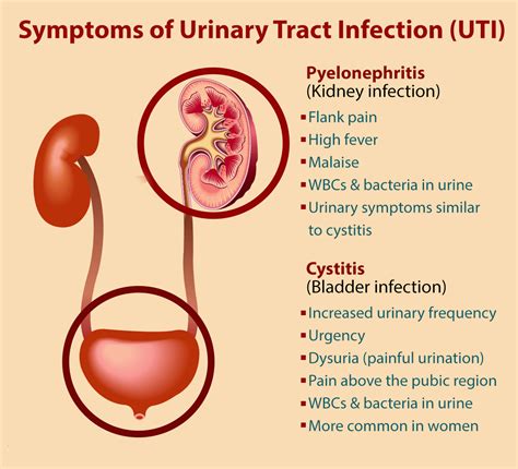 In Pregnant Women UTIs Pose A Special Concern Because They Are Not Only Common But They Incr