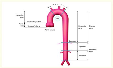 Segments Of The Ascending And Descending Aorta Rpa Right Pulmonary
