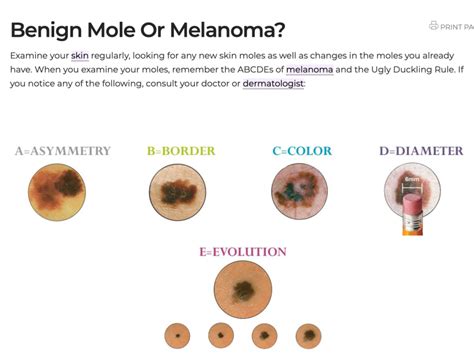 Melanoma Monday The Abcs Of Skin Cancer Grace Medical Clinic