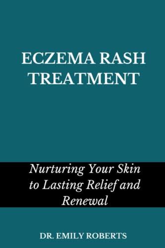 Eczema Rash Treatment Nurturing Your Skin To Lasting Relief And