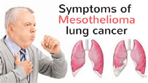 Know The Differences Between Mesothelioma And Asbestosis