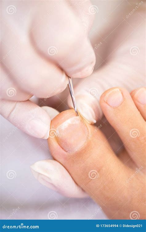 Toenail Cleaning In Close Up Stock Photo Image Of Beautiful Close