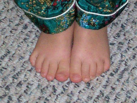 Karen Edmisten Flintstone Feet