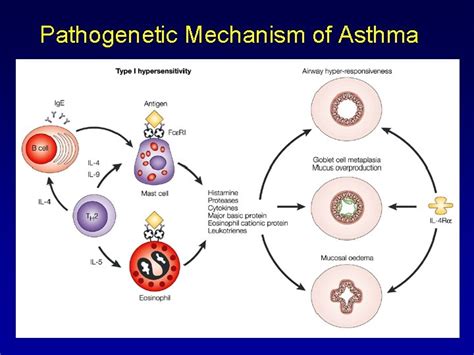 Asthma Definition Pathophysiology Pathogenesis 1 Asthma Is A