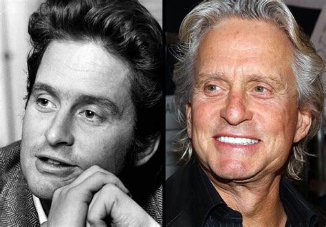 Michael Douglas Before And After Plastic Surgery 24 Celebrity