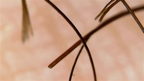 Split Ends And Breakage Under A Microscope Youtube