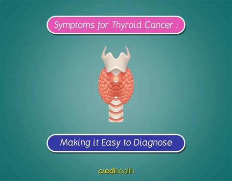 Thyroid Cancer Signs And Symptoms Credihealth