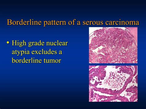 Compared to invasive epithelial ovarian cancers, bot occurs more commonly at a younger age, during the time of. PPT - Ovarian Borderline Tumors: PowerPoint Presentation ...