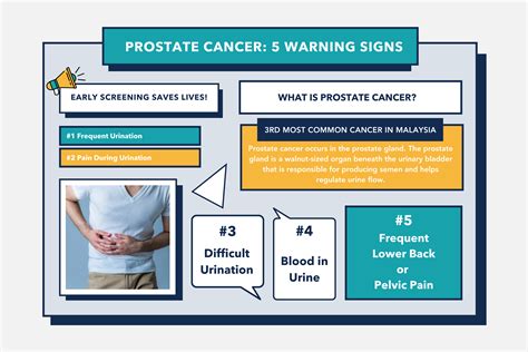 Prostate Cancer Spot The 5 Warning Signs Homage Malaysia