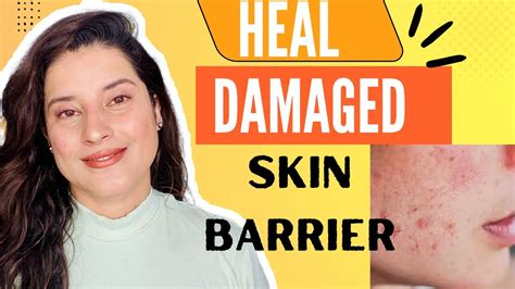How To Heal Damaged Skin Barrierget Rid Of Pigmentation Youtube