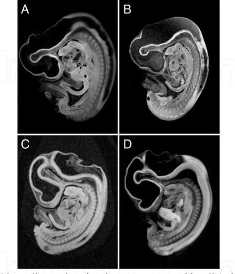 Figure 3 From Developmental Anatomy Of The Human Embryo 3d Imaging