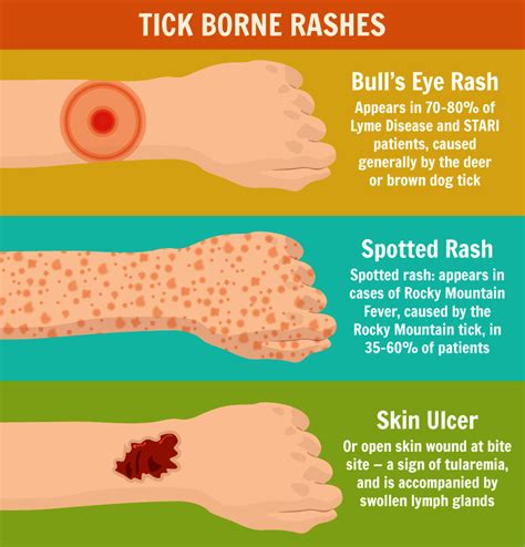Ticks Dangers And Precautions