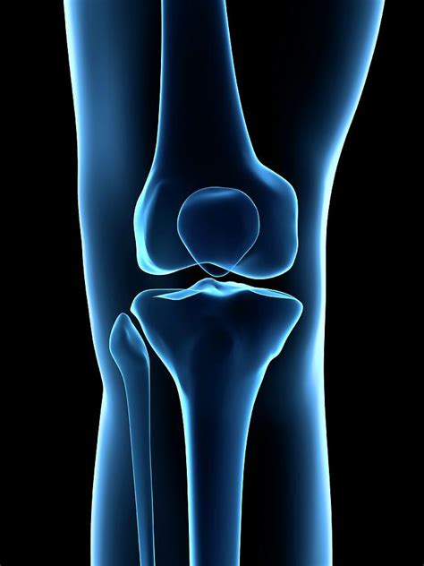 Human Knee Joint Photograph By Sebastian Kaulitzki Fine Art America
