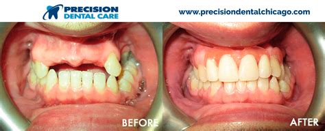4352 w diversey ave, chicago (il), 60639, united states. Precision Dental Care | The Best Dentists in Chicago IL