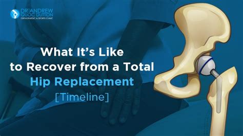 Total Hip Replacement Recovery [timeline] Dr Andrew Dutton