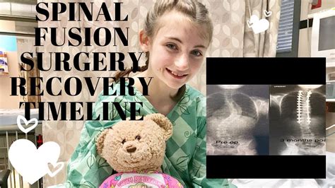 Spinal Fusion Surgery Recovery Timeline Youtube