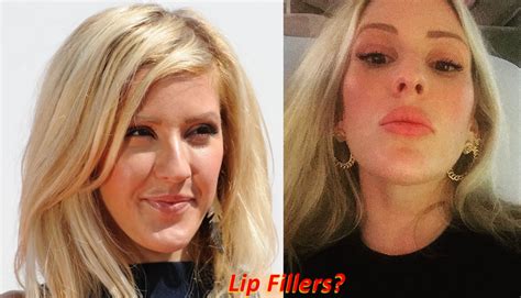 Ellie Goulding Plastic Surgery Before And After Boob Job Lip Fillers
